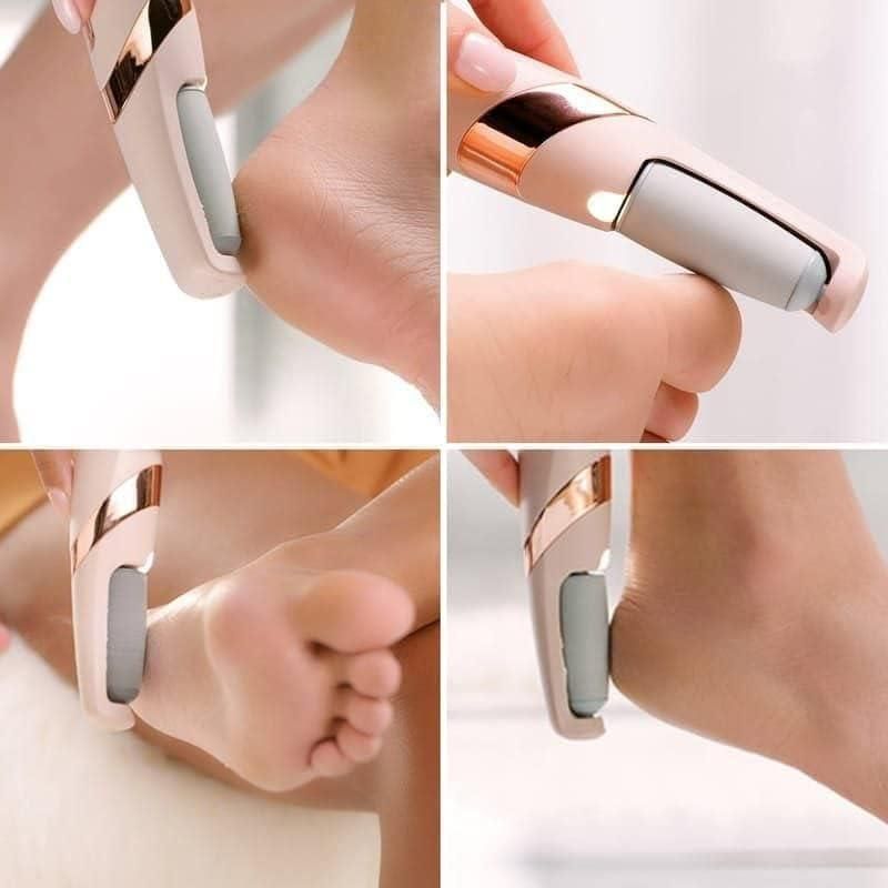 Electronic Pedicure Callus Dead Skin Remover